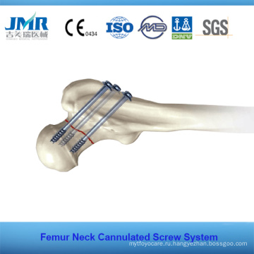 Ортопедический имплантат Femur Neck